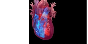 New research finds 62% of AFib patients were unaware of the condition before diagnosis
