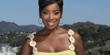 RHOA Star Shamea Morton SUES Atlanta Doctor After Chemical Peel BURNS Her Back!