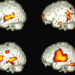 How Does One Brain Speak Two Languages?