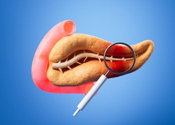 New AI Tool Boosts Pancreatic Cancer Detection – Asian Scientist Magazine