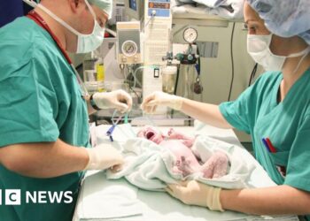 One in four births in England are now emergency caesareans, BBC analysis shows
