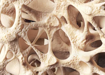 Osteopenia is silently weakening bones in millions of people